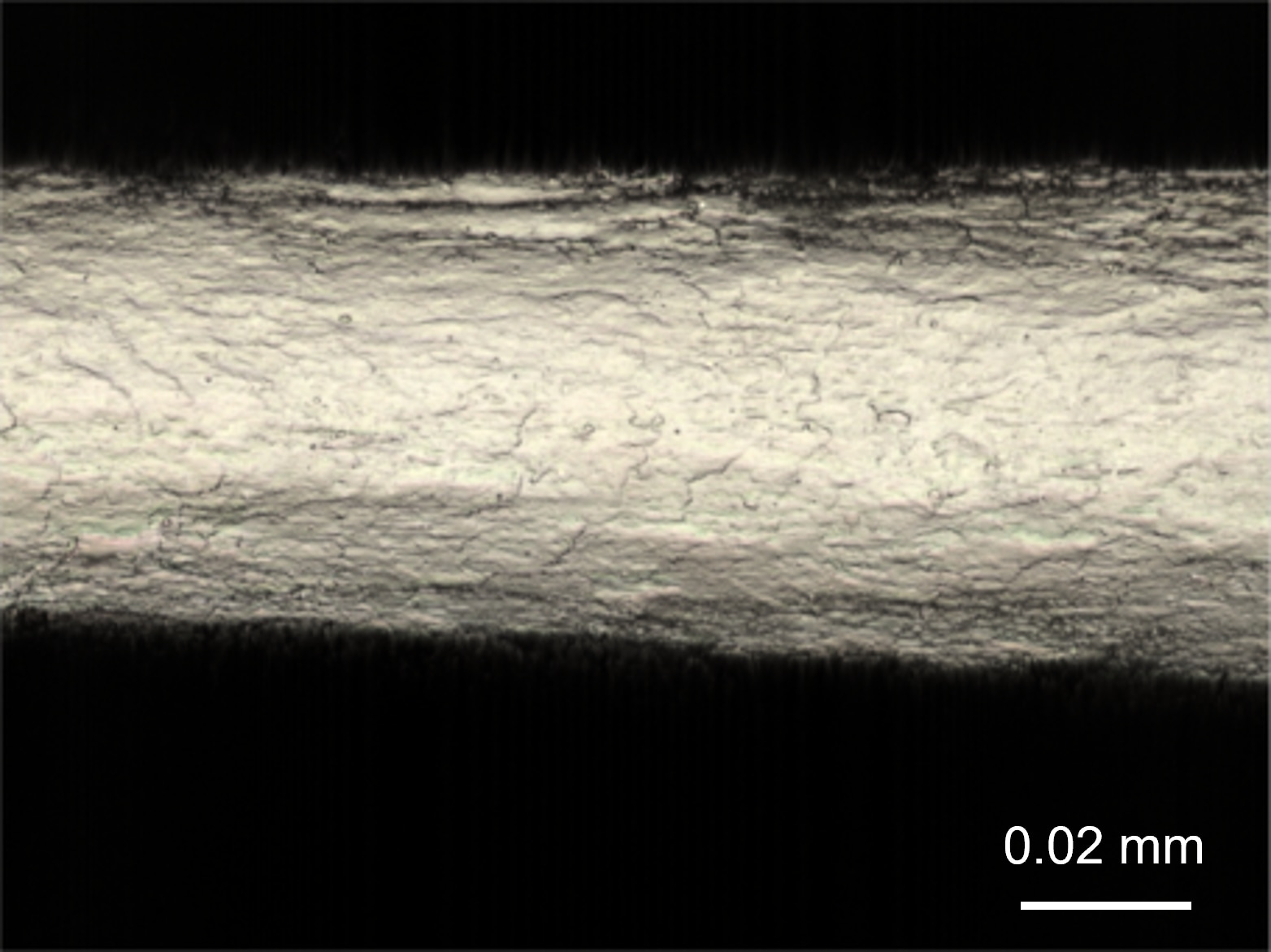 キューティクルがほとんどなくコルテックスが露出した毛髪表面