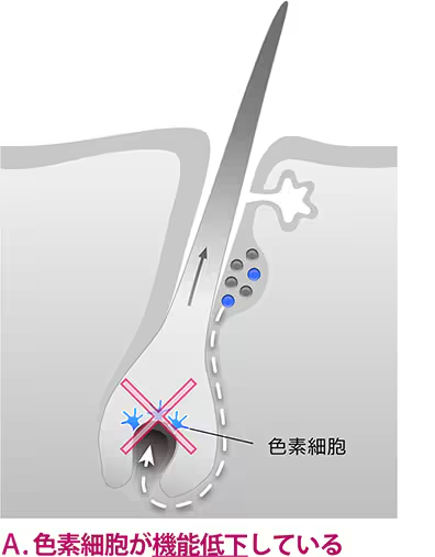色素細胞が機能低下している場合
