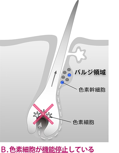 色素細胞が機能停止している場合