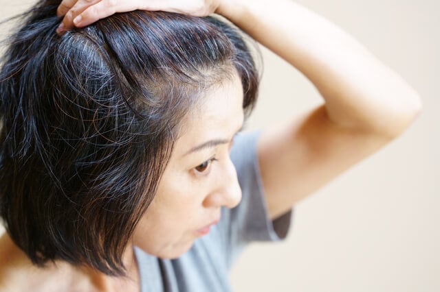 フケの原因とは